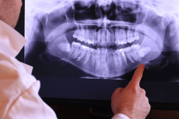 Best Emergency Dental Extractions in Springville, IA
